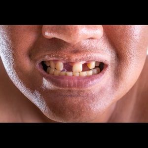 Meet your Posher, Kyle